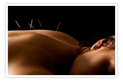 Acupuncture